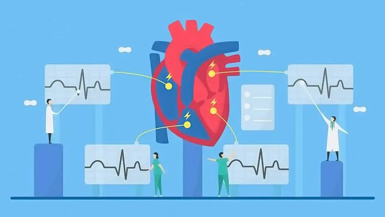 تفسیر نوار قلب (ECG یا EKG) - نبض هوشمند سلامت
